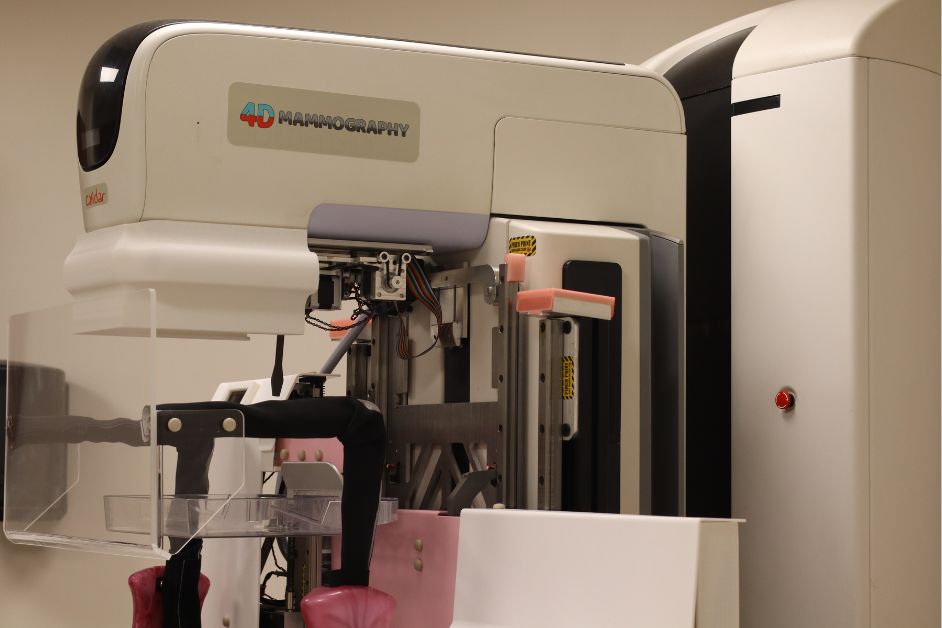 4D Mammography